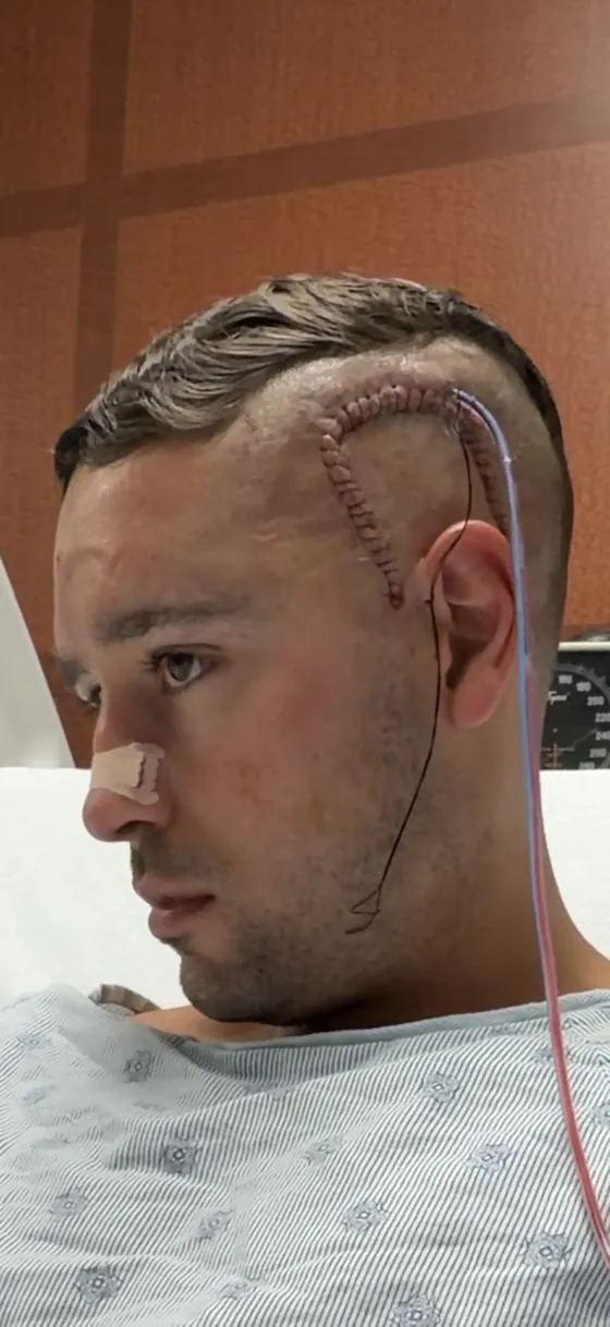 The surgical incision healing
